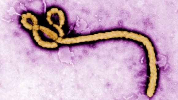 Ebola, sistema sangue italiano sicuro